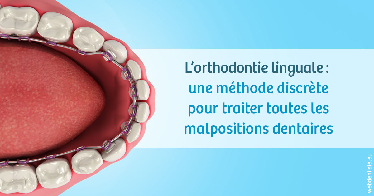 https://cabinetdentaireimplantaire.com/L'orthodontie linguale 1