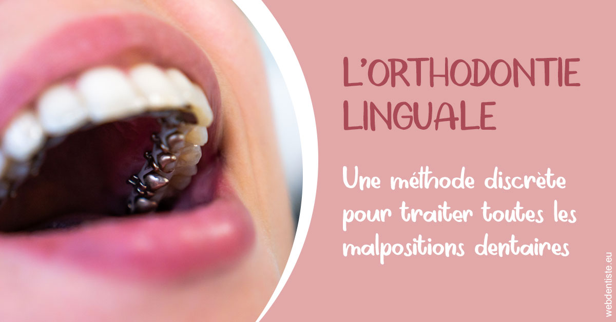 https://cabinetdentaireimplantaire.com/L'orthodontie linguale 2