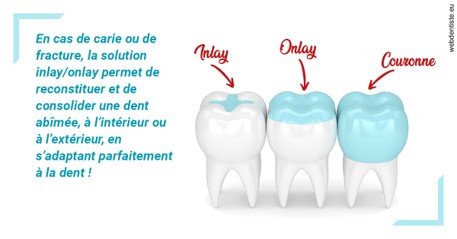 https://cabinetdentaireimplantaire.com/L'INLAY ou l'ONLAY