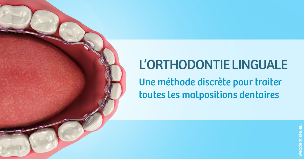 https://cabinetdentaireimplantaire.com/L'orthodontie linguale 1