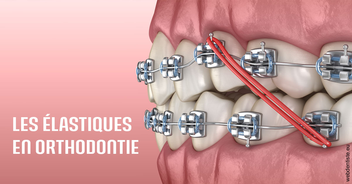 https://cabinetdentaireimplantaire.com/Elastiques orthodontie 2