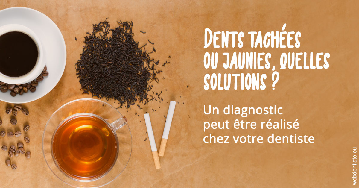 https://cabinetdentaireimplantaire.com/Dents tachées 2