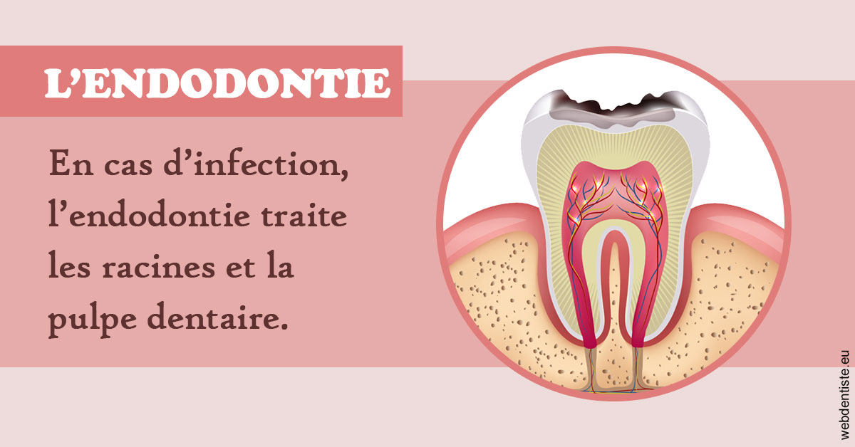 https://cabinetdentaireimplantaire.com/L'endodontie 2