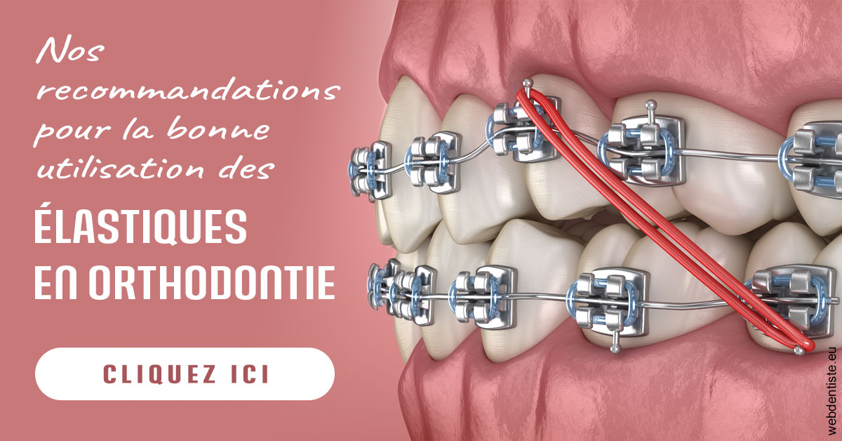 https://cabinetdentaireimplantaire.com/Elastiques orthodontie 2